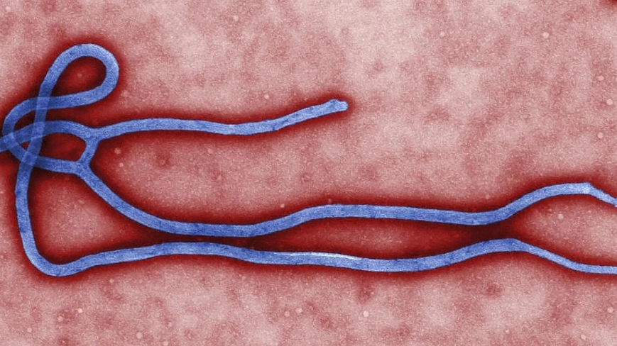FDA授予Soligenix孤儿药资格，用于预防和暴露后预防苏丹埃博拉病毒感染