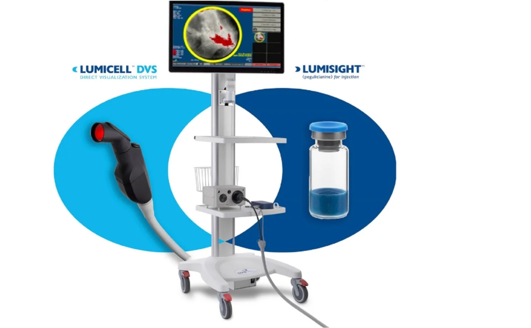 光学成像剂Lumisight获批，用于检测肿块切除术中残留的乳腺癌